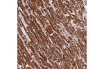 Immunohistochemical staining of human Heart muscle shows strong cytoplasmic positivity in cardiomyocytes.
