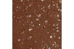 Immunohistochemical staining of human cerebral cortex shows strong positivity in neuropil.