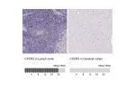 Immunohistochemistry analysis in human lymph node and cerebral cortex tissues using HPA045942 antibody. Corresponding CXCR3 RNA-seq data are presented for the same tissues.