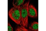 Immunofluorescent staining of human cell line A-431 shows localization to nucleoplasm.