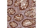 Immunohistochemical staining of human colon shows strong cytoplasmic and membranous positivity in glandular cells.