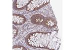 Immunohistochemical staining of human rectum shows strong cytoplasmic positivity in glandular cells.