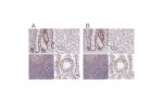 Immunohistochemical staining of human gastrointestinal, kidney, lymphoid tissues and testis using Anti-PTPN2 antibody HPA046176 (A) shows similar protein distribution across tissues to independent antibody HPA015004 (B).