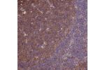 Immunohistochemical staining of human lymph node shows cytoplasmic positivity in germinal center.