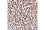 Immunohistochemical staining of human kidney shows strong cytoplasmic positivity in renal tubules.