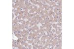 Immunohistochemical staining of human urinary bladder shows positivity in plasma.