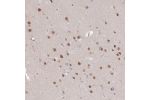 Immunohistochemical staining of human cerebral cortex shows strong nuclear positivity in neurons.