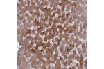 Immunohistochemical staining of human liver shows moderate cytoplasmic positivity in hepatocytes.
