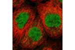Immunofluorescent staining of human cell line A-431 shows localization to nucleoplasm.