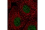 Immunofluorescent staining of human cell line A-431 shows localization to nucleoplasm.
