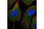 Immunofluorescent staining of human cell line U-2 OS shows localization to cytosol.