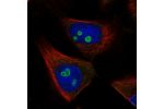 Immunofluorescent staining of human cell line U-251 MG shows localization to nucleoli.
