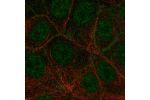 Immunofluorescent staining of human cell line MCF7 shows localization to nucleoplasm & plasma membrane.