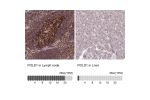 Immunohistochemistry analysis in human lymph node and liver tissues using HPA046524 antibody. Corresponding POLD1 RNA-seq data are presented for the same tissues.