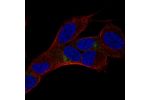 Immunofluorescent staining of human cell line SH-SY5Y shows localization to the Golgi apparatus.