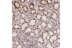Immunohistochemical staining of human stomach shows strong nuclear positivity in glandular cells.
