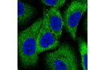 Immunofluorescent staining of human cell line A549 shows localization to cytosol.