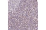 Immunohistochemical staining of human tonsil shows weak cytoplasmic positivity in non-germinal center cells.