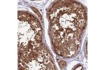 Immunohistochemical staining of human placenta shows strong cytoplasmic positivity in trophoblastic cells and decidual cells.