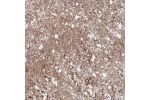 Immunohistochemical staining of human caudate shows distinct positivity.