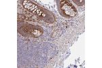 Immunohistochemical staining of human rectum shows strong cytoplasmic positivity in glandular cells.
