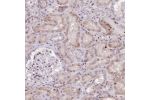 Immunohistochemical staining of human kidney shows moderate nuclear positivity in cells in tubules and cells in glomeruli.