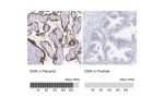 Immunohistochemistry analysis in human placenta and prostate tissues using HPA046635 antibody. Corresponding EBI3 RNA-seq data are presented for the same tissues.