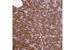 Immunohistochemical staining of human pancreas shows strong cytoplasmic positivity in exocrine glandular cells.