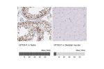 Immunohistochemistry analysis in human testis and skeletal muscle tissues using HPA046660 antibody. Corresponding GTF2H1 RNA-seq data are presented for the same tissues.