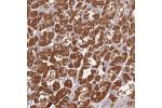 Immunohistochemical staining of human stomach, upper shows strong cytoplasmic positivity in glandular cells.