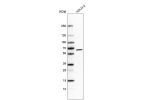 Western blot analysis in human cell line HDLM-2.