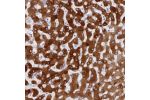 Immunohistochemical staining of human liver shows strong granular cytoplasmic positivity in hepatocytes.