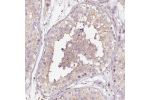 Immunohistochemical staining of human testis shows weak cytoplasmic positivity in cells in seminiferous ducts.