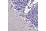 Immunohistochemical staining of human cerebellum shows moderate cytoplasmic positivity in Purkinje cells.