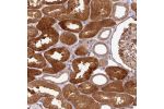 Immunohistochemical staining of human kidney shows strong cytoplasmic, membranous and nuclear positivity in renal tubules.