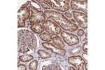 Immunohistochemical staining of human kidney shows strong cytoplasmic positivity in cells in tubules.