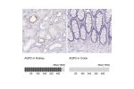 Immunohistochemistry analysis in human kidney and colon tissues using HPA046834 antibody. Corresponding AQP2 RNA-seq data are presented for the same tissues.