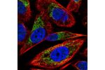 Immunofluorescent staining of human cell line PC-3 shows localization to mitochondria.