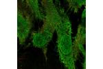 Immunofluorescent staining of human cell line HUVEC TERT2 shows localization to nuclear speckles, nuclear membrane & plasma membrane.