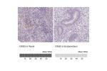 Immunohistochemistry analysis in human esophagus and stomach tissues using Anti-DSG3 antibody. Corresponding DSG3 RNA-seq data are presented for the same tissues.