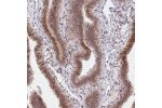 Immunohistochemical staining of human Fallopian tube shows moderate nuclear positivity in glandular cells.
