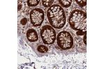 Immunohistochemical staining of human colon shows moderate to strong cytoplasmic positivity in glandular cells.