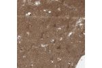 Immunohistochemical staining of human cerebral cortex shows moderate granular cytoplasmic positivity in neurons.
