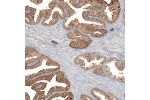 Immunohistochemical staining of human prostate shows strong cytoplasmic positivity in glandular cells.