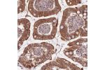 Immunohistochemical staining of human small intestine shows strong cytoplasmic and nuclear positivity in glandular cells.