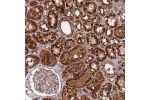 Immunohistochemical staining of human kidney shows strong granular cytoplasmic positivity in cells in tubules.
