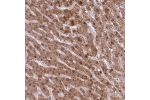 Immunohistochemical staining of human liver shows moderate cytoplasmic and nuclear positivity in hepatocytes.