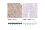 Immunohistochemistry analysis in human placenta and skeletal muscle tissues using HPA046972 antibody. Corresponding IGFBP1 RNA-seq data are presented for the same tissues.