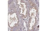 Immunohistochemical staining of human Endometrium shows moderate cytoplasmic positivity in glandular cells.