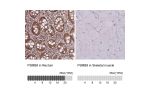Immunohistochemistry analysis in human lymph node and pancreas tissues using Anti-PSMB8 antibody. Corresponding PSMB8 RNA-seq data are presented for the same tissues.